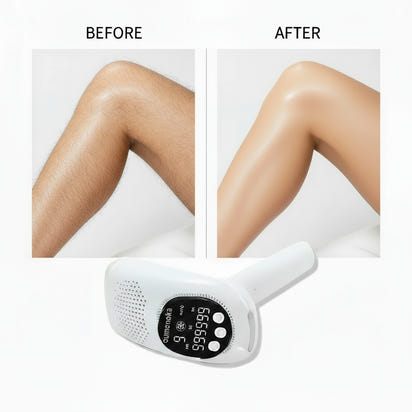 999999 Flashes IPL Laser Epilator for Women Home Use Devices Hair Removal Painless Electric Epilator Bikini Dropshipping